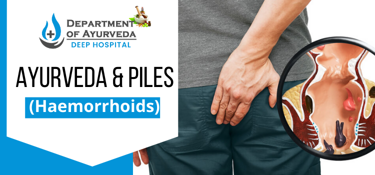Banner: Ayurveda and Piles (Haemorrhoids)